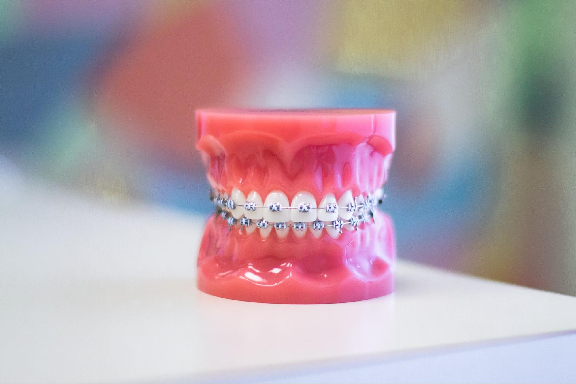 Braces Myths You Need to Know