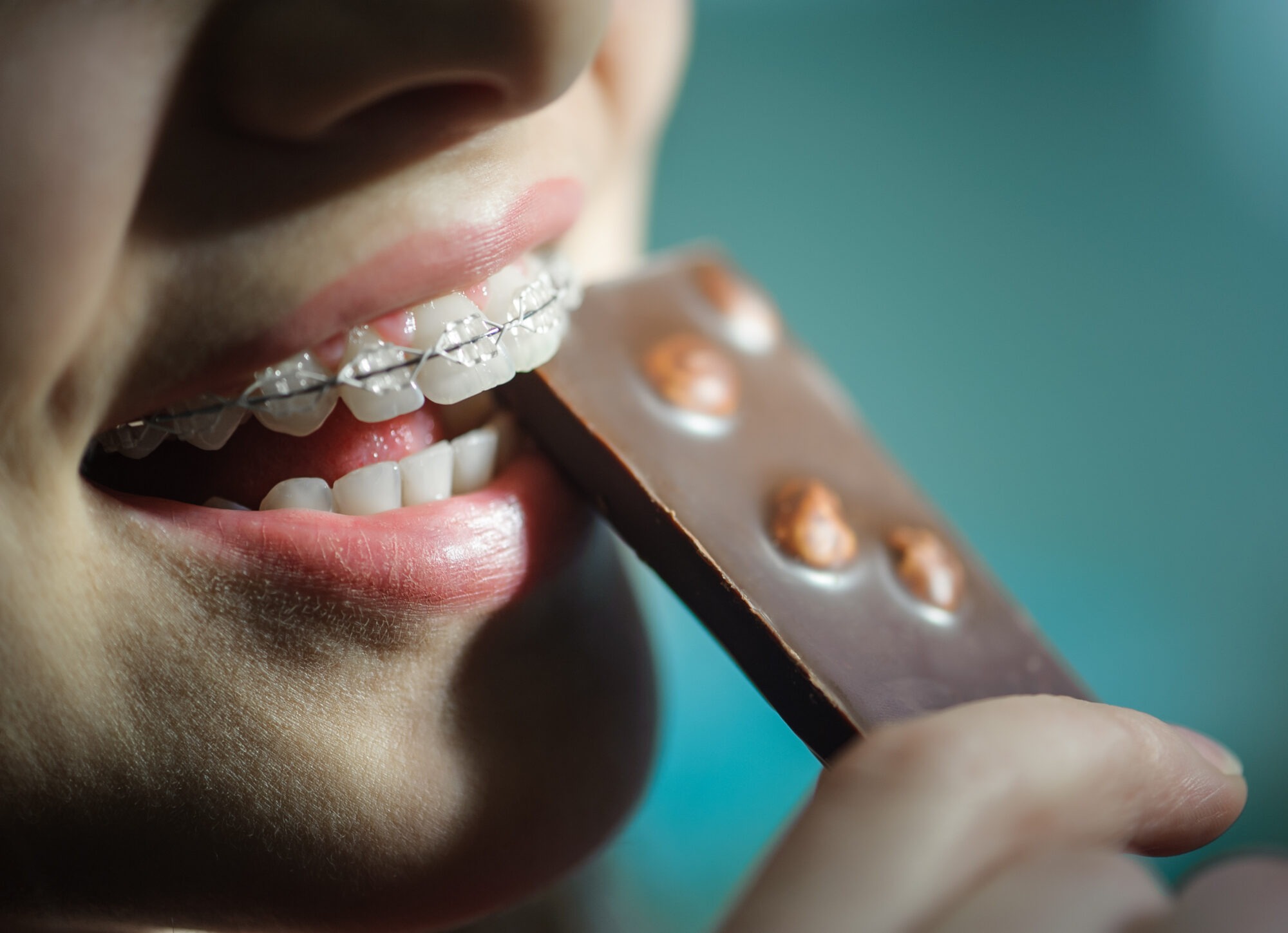Orthodontic Health Month: Enjoying Sweet Treats With Braces