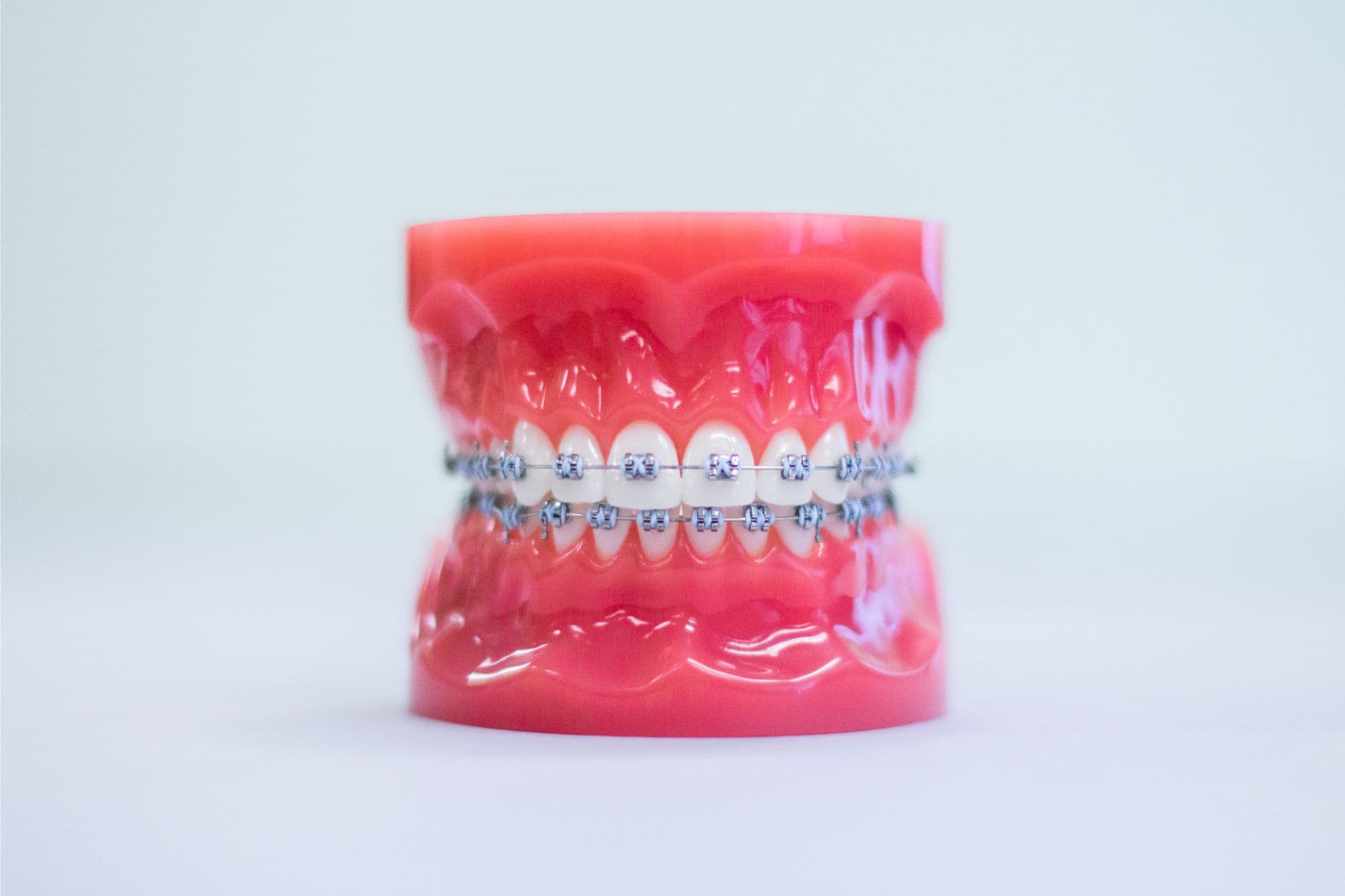 Logan Orthodontics - Metal Braces Logan Orthodontics - Metal Braces