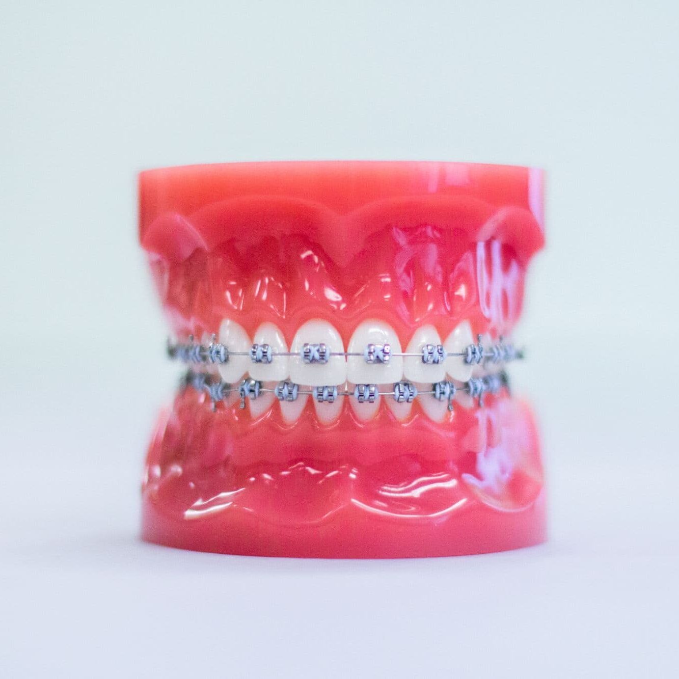 braces logan UT